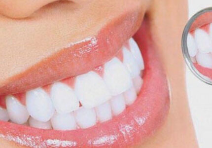 boc-rang-su-khong-may