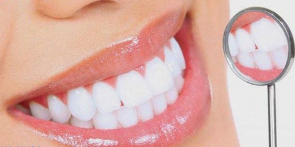 boc-rang-su-khong-may